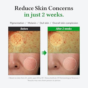 Dr. Althea – Gentle Vitamin C Serum 20% (30ml)