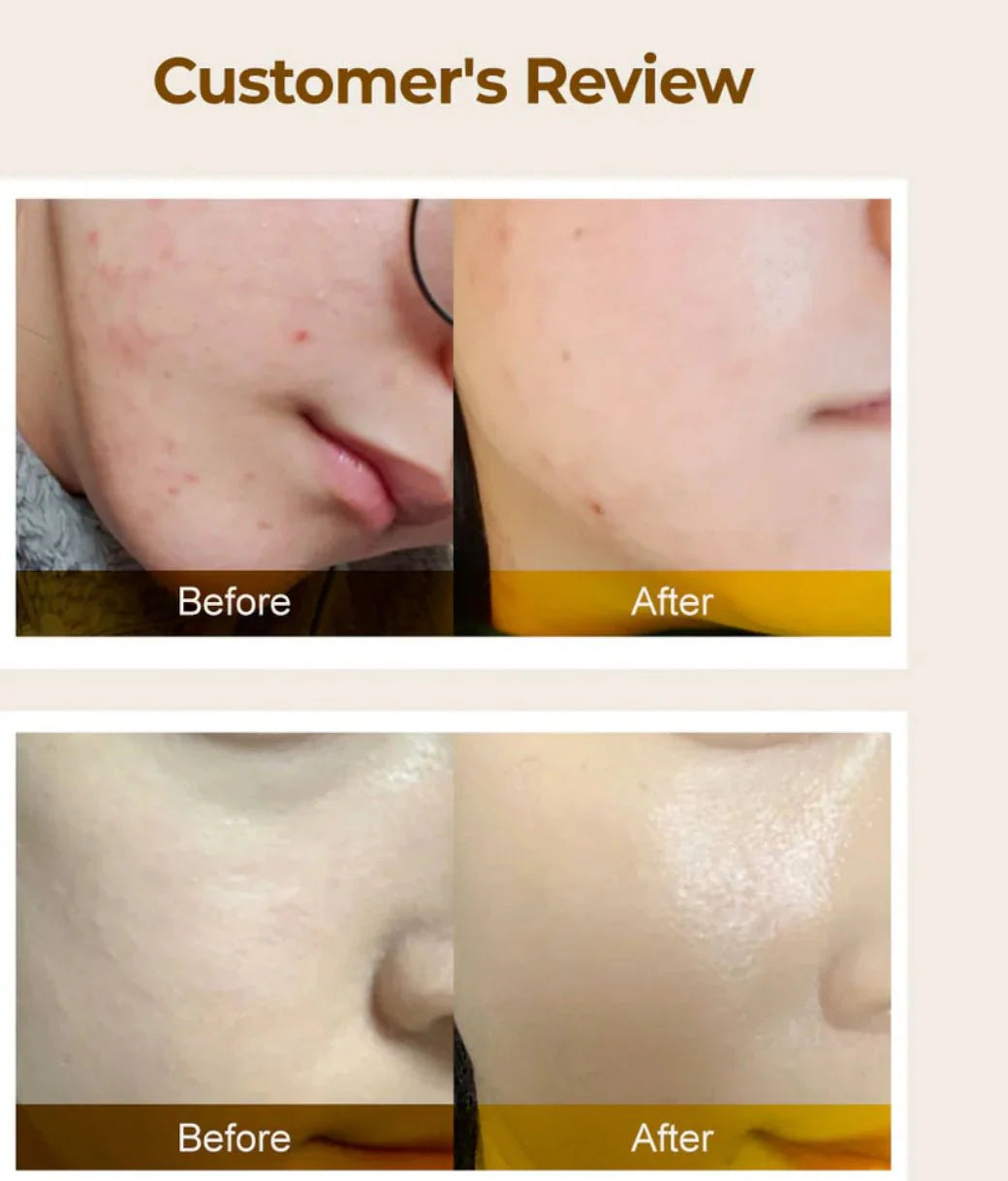 Numbuzin Vitamin Concentrated Serum 5+ (30ml) |