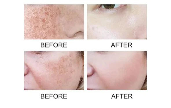 Anua Niacinamide 10% + TXA 4 Serum (30ml)