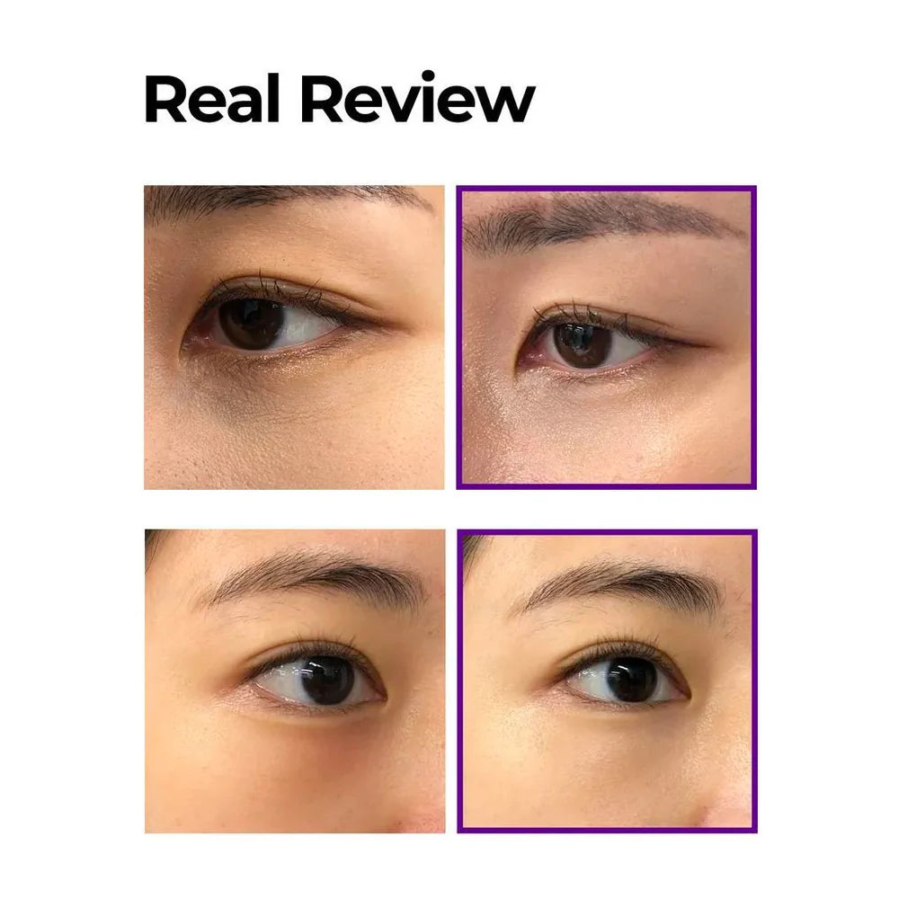 SOME BY MI – Retinol Intense Advanced Triple Action Eye Crea