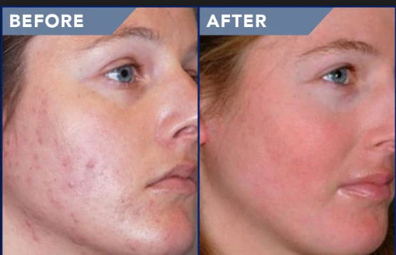 Sudocrem Crème Antiseptique Cicatrisante