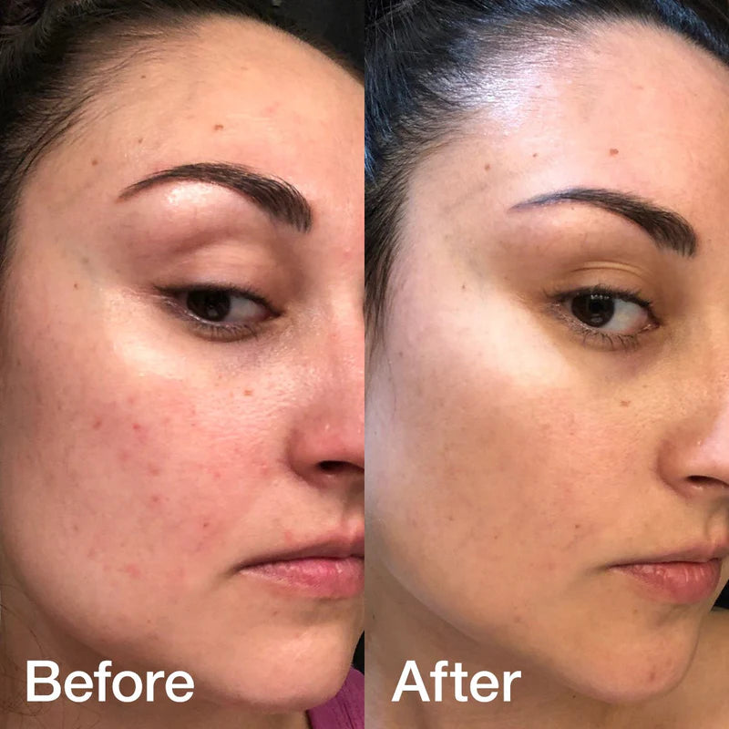 Medicube Triple Collagen Serum (30ml)