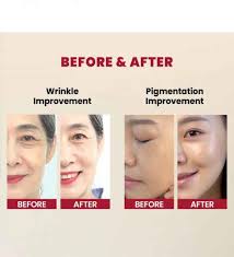 Seoul 1988 – Retinal Liposome 2% + Black Ginseng Serum (30ml)