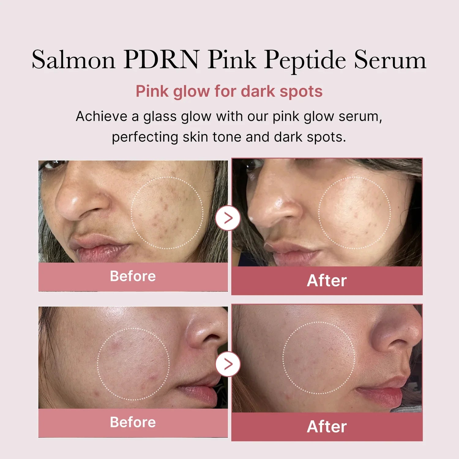 Medicube – PDRN Pink Peptide Glow Serum (50ml)